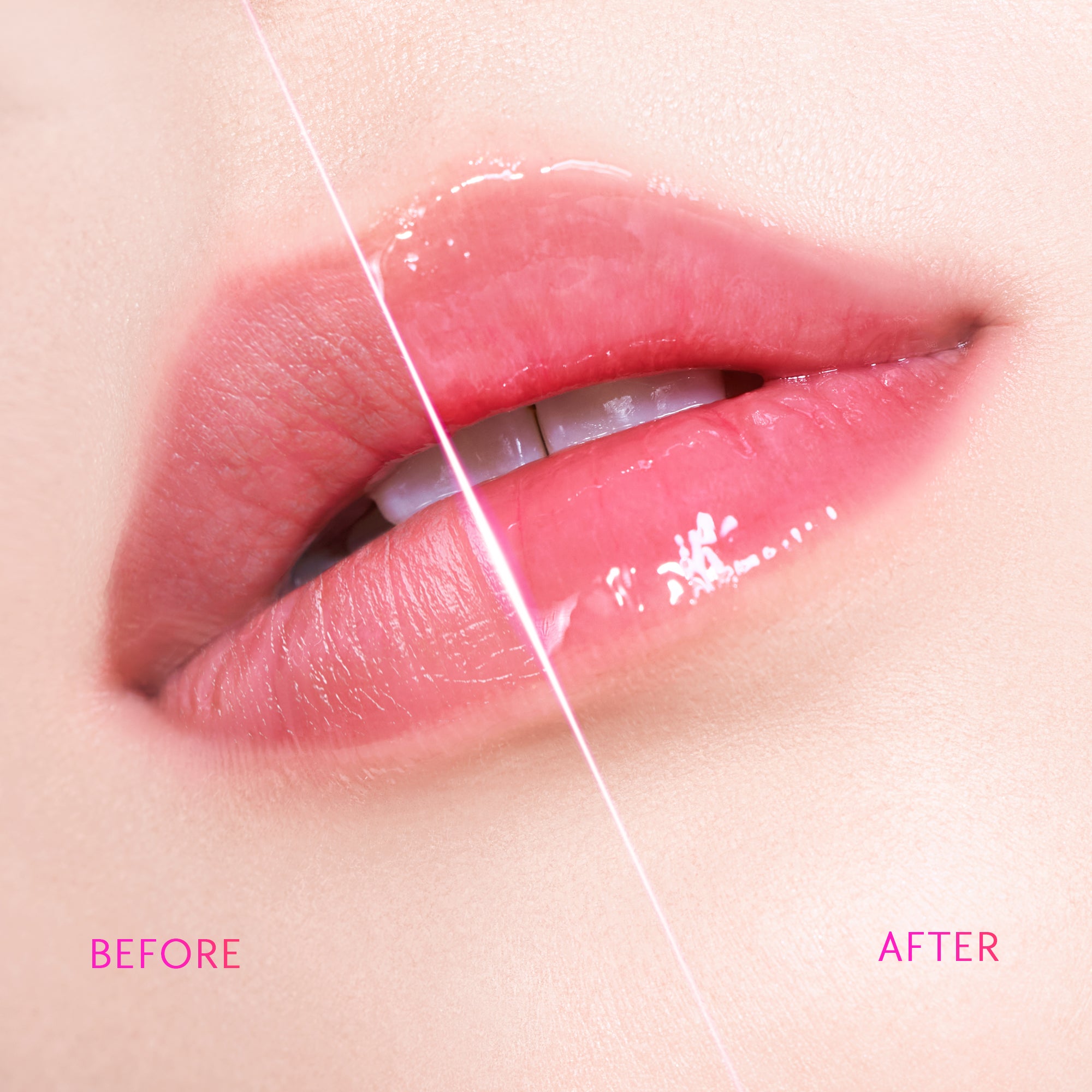 Brightening Lip Serum
