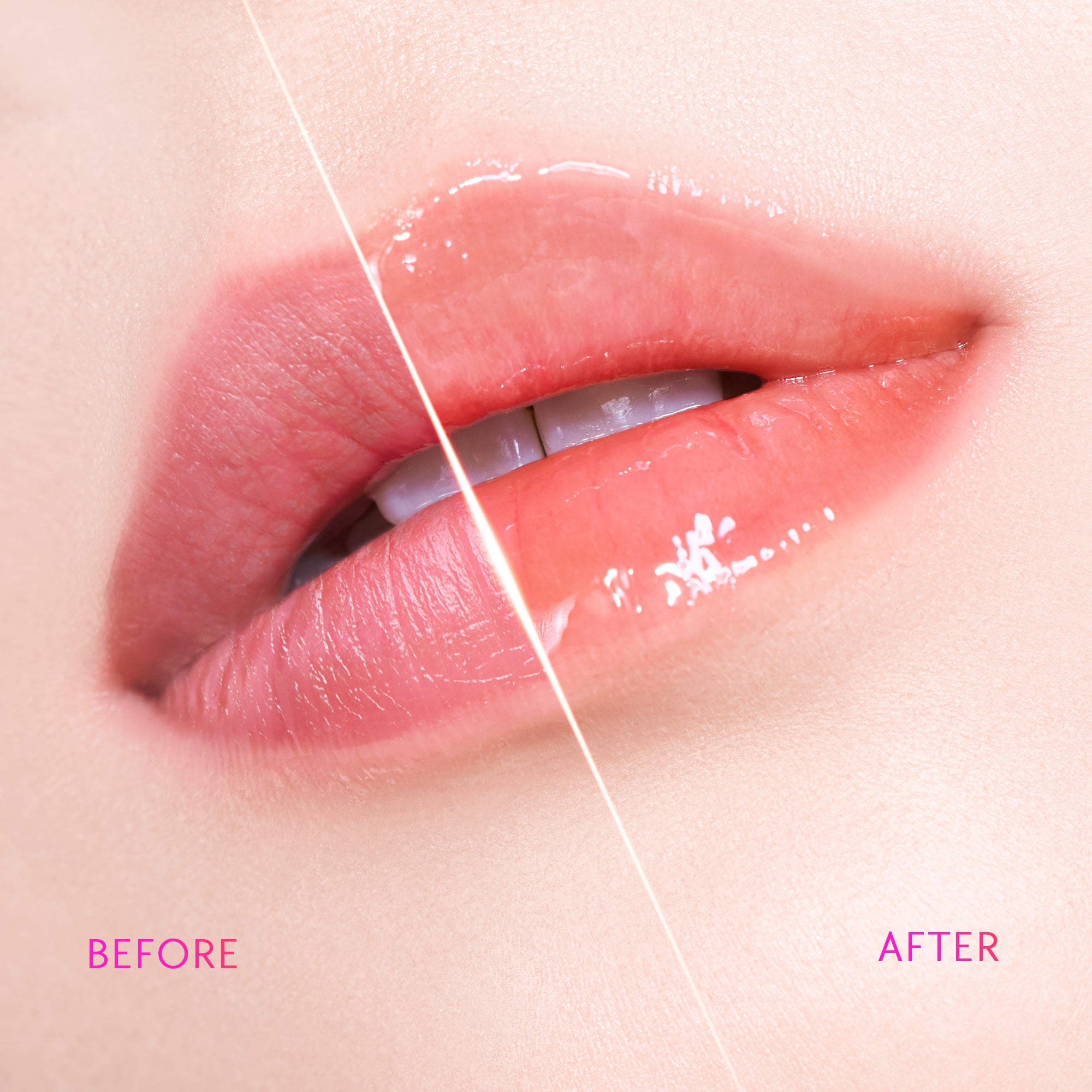 Brightening Lip Serum