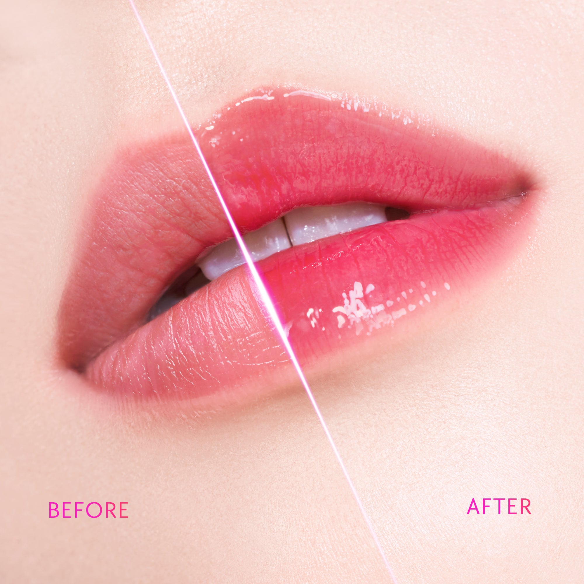 Brightening Lip Serum